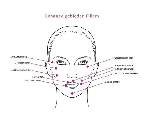 Natuurlijke lip- en jukbeenfiller behandeling bij Clinic3D Hasselt